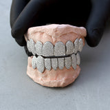 Fully Iced Out Diamond Grills - Fenom & Co.