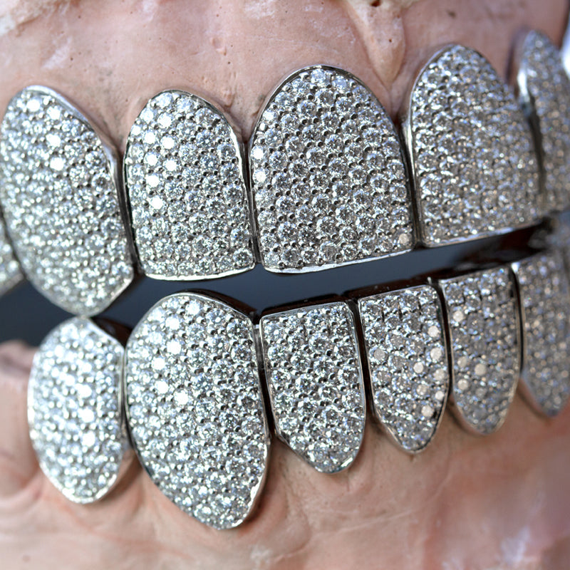 Fully Iced Out Diamond Grills - Fenom & Co.