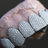 Fully Iced Out Diamond Grills - Fenom & Co.